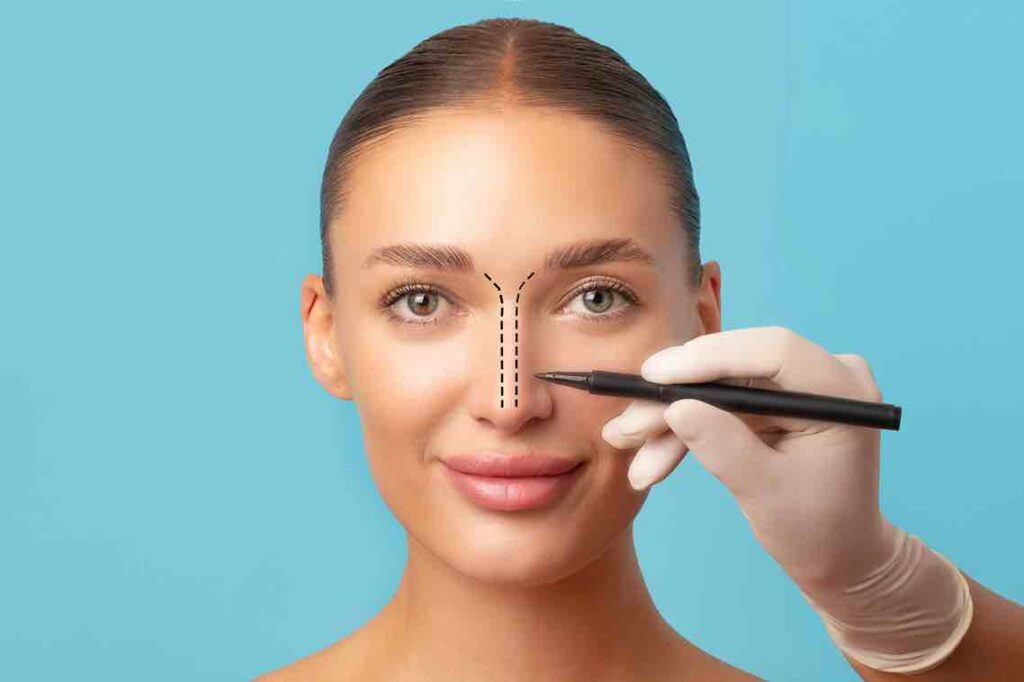 RECUPERAÇÃO DA RINOPLASTIA